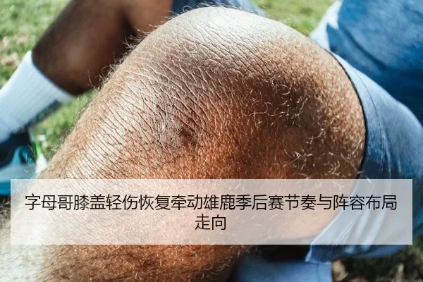 字母哥膝盖轻伤恢复牵动雄鹿季后赛节奏与阵容布局走向